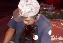 Termina paseo en Buctzotz con el rostro rebanado