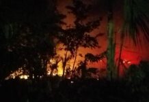 Mujer sufre quemaduras tras incendiarse su casa