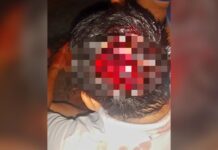 Agarrón en la vía pública deja a un sujeto con la cabeza partida