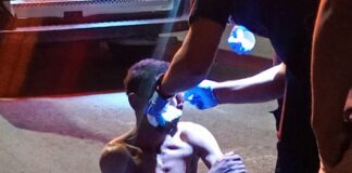 Paramédicos atienden a un hombre lesionado tras caer de una banqueta en la colonia Emiliano Zapata Sur de Mérida.