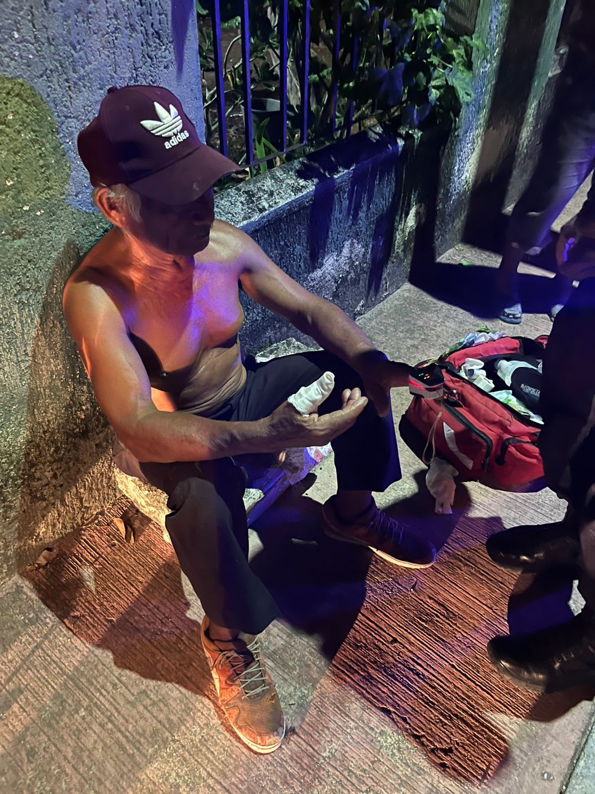 Perro muerde a su dueño tras resultar lesionado en Tizimín.